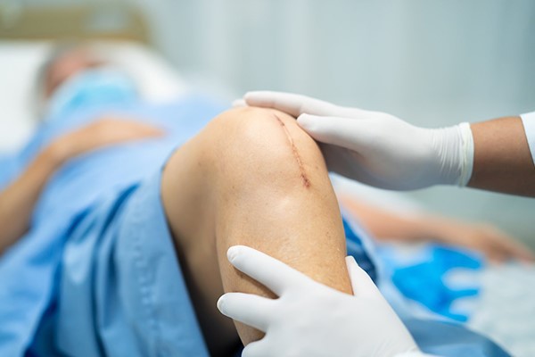 مشاهده و ارزیابی عمق بخیه توسط پزشک و بهکار گیری از دستگاه لیزر