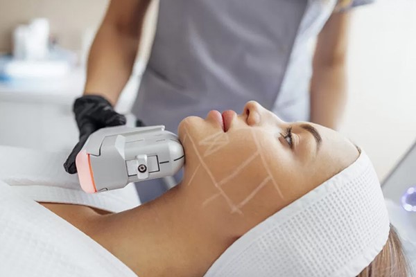 لیفت صورت و رفع افتادگی پوست بعد از لاغری با دستگاه هایفو