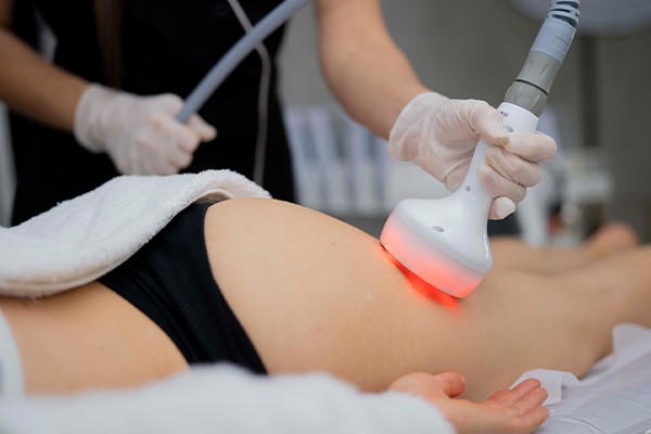 استفاده از دستگاه آر اف فرکشنال برای سفت کردن پوست بدن بعد از لاغری