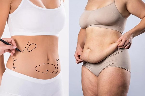 قبل و بعد بهرهمندی از جلسات درمانی دستگاه آر اف