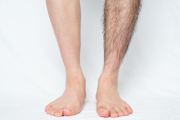 ضخامت و رنگ موی تیره و تاثیر مثبت لیزر در رفع آن