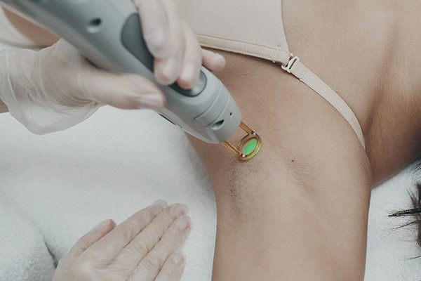 نوع دستگاه لیزر و تاثیر آن در تیرگی پوست 