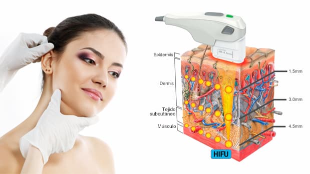 بازیگرانی که هایفو کرده‌اند