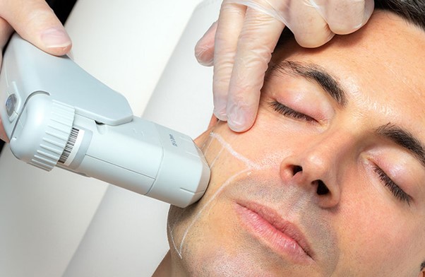 مزایای مصرف قرص کلاژن ساز بعد از هایفو